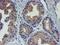 Vascular Cell Adhesion Molecule 1 antibody, TA502392, Origene, Immunohistochemistry frozen image 