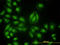 Non-receptor tyrosine-protein kinase TYK2 antibody, LS-C133500, Lifespan Biosciences, Immunofluorescence image 