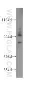 Forkhead box protein P4 antibody, 16772-1-AP, Proteintech Group, Western Blot image 