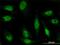Zinc Finger Protein 181 antibody, H00339318-M01, Novus Biologicals, Immunocytochemistry image 