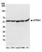 ATP Synthase F1 Subunit Alpha antibody, A304-939A, Bethyl Labs, Western Blot image 