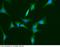 HPX antibody, 10870-MM01, Sino Biological, Immunohistochemistry paraffin image 