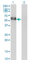 Activin A Receptor Type 1 antibody, LS-C196608, Lifespan Biosciences, Western Blot image 