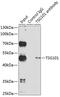Tumor Susceptibility 101 antibody, 18-579, ProSci, Immunoprecipitation image 