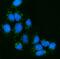 NPC1 Like Intracellular Cholesterol Transporter 1 antibody, A01954, Boster Biological Technology, Immunofluorescence image 