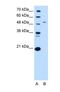 Spt1 antibody, NBP1-59643, Novus Biologicals, Western Blot image 