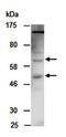 High affinity immunoglobulin gamma Fc receptor I antibody, orb67005, Biorbyt, Western Blot image 