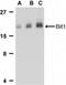 Peptidyl-TRNA Hydrolase 2 antibody, NB100-55963, Novus Biologicals, Western Blot image 