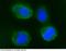 CD55 Molecule (Cromer Blood Group) antibody, 10101-R028, Sino Biological, Immunohistochemistry frozen image 