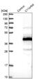 Chromosome 11 Open Reading Frame 49 antibody, NBP1-82128, Novus Biologicals, Western Blot image 