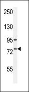 Arachidonate 12-Lipoxygenase, 12R Type antibody, LS-C156289, Lifespan Biosciences, Western Blot image 