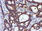 LIM Domain Kinase 1 antibody, M01323, Boster Biological Technology, Immunohistochemistry paraffin image 