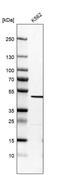Glutaryl-CoA Dehydrogenase antibody, PA5-61754, Invitrogen Antibodies, Western Blot image 