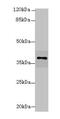 N-Acetyltransferase 2 antibody, A59994-100, Epigentek, Western Blot image 