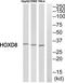 Homeobox D8 antibody, TA314032, Origene, Western Blot image 
