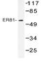 ETV1 antibody, AP20524PU-N, Origene, Western Blot image 