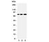 SNK antibody, R31246, NSJ Bioreagents, Western Blot image 