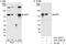 ZFP36 Ring Finger Protein Like 1 antibody, A301-227A, Bethyl Labs, Immunoprecipitation image 