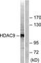 Histone Deacetylase 9 antibody, TA314963, Origene, Western Blot image 