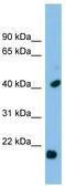 Heat shock protein beta-2 antibody, TA346550, Origene, Western Blot image 