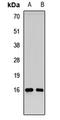 RecQ Mediated Genome Instability 2 antibody, LS-C668989, Lifespan Biosciences, Western Blot image 