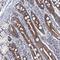 Mitochondrial Ribosomal Protein L51 antibody, HPA039923, Atlas Antibodies, Immunohistochemistry paraffin image 