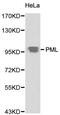 Promyelocytic Leukemia antibody, LS-C192443, Lifespan Biosciences, Western Blot image 