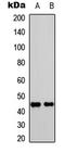C-X-C Motif Chemokine Receptor 2 antibody, LS-C358963, Lifespan Biosciences, Western Blot image 