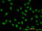 XPA Binding Protein 2 antibody, LS-C133791, Lifespan Biosciences, Immunofluorescence image 