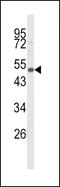 Cytochrome P450 Family 24 Subfamily A Member 1 antibody, 63-567, ProSci, Western Blot image 