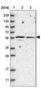 SH3 Domain Binding Protein 2 antibody, PA5-57818, Invitrogen Antibodies, Western Blot image 