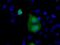 RAB17, Member RAS Oncogene Family antibody, NBP2-02599, Novus Biologicals, Immunocytochemistry image 