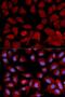 Proteasome 26S Subunit, ATPase 4 antibody, LS-C332127, Lifespan Biosciences, Immunofluorescence image 