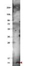 Purple acid phosphatase antibody, orb344866, Biorbyt, Western Blot image 