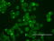 ERBB2 antibody, LS-C796708, Lifespan Biosciences, Immunofluorescence image 