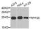 Ribonuclease P And MRP Subunit P25 antibody, A9973, ABclonal Technology, Western Blot image 