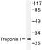 Troponin I, cardiac muscle antibody, AP06588PU-N, Origene, Western Blot image 