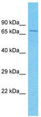 Nucleolar Protein 10 antibody, TA337468, Origene, Western Blot image 