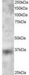 Krueppel-like factor 16 antibody, TA302801, Origene, Western Blot image 