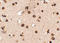 Regulating Synaptic Membrane Exocytosis 3 antibody, A13058, Boster Biological Technology, Immunohistochemistry paraffin image 