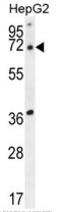 Acyl-CoA Thioesterase 11 antibody, AP50050PU-N, Origene, Western Blot image 