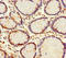 Parathyroid hormone-related protein antibody, A54479-100, Epigentek, Immunohistochemistry paraffin image 