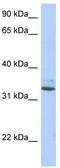 Stp antibody, TA331008, Origene, Western Blot image 