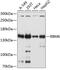 RNA Binding Motif Protein 6 antibody, GTX65560, GeneTex, Western Blot image 