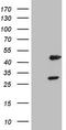 Nuclear Receptor Subfamily 1 Group I Member 3 antibody, TA805288, Origene, Western Blot image 
