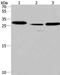 Interleukin 1 Receptor Associated Kinase 1 Binding Protein 1 antibody, PA5-50231, Invitrogen Antibodies, Western Blot image 