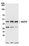 Snurportin-1 antibody, A305-568A, Bethyl Labs, Western Blot image 