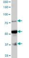 Armadillo Repeat Containing 6 antibody, H00093436-B01P, Novus Biologicals, Western Blot image 