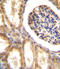 Discoidin Domain Receptor Tyrosine Kinase 1 antibody, 63-111, ProSci, Immunohistochemistry paraffin image 
