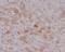 C-Reactive Protein antibody, M00249, Boster Biological Technology, Immunohistochemistry frozen image 